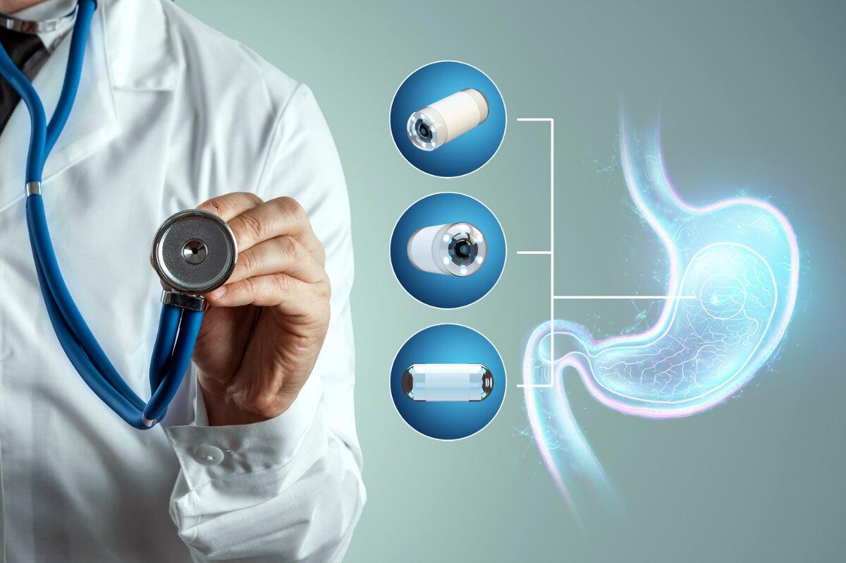 Endoscopía CHIHUAHUA